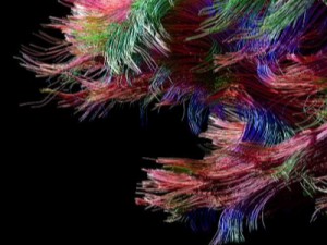 Illustration extraite du site de Manuel Lima : projet Synapse (auteurs Mark Hansen, Laura Kurgan, Jochen Hartmann, Caitlin Shure, Annelie Berner, Madeeha Merchant, Mondrian Hsieh)